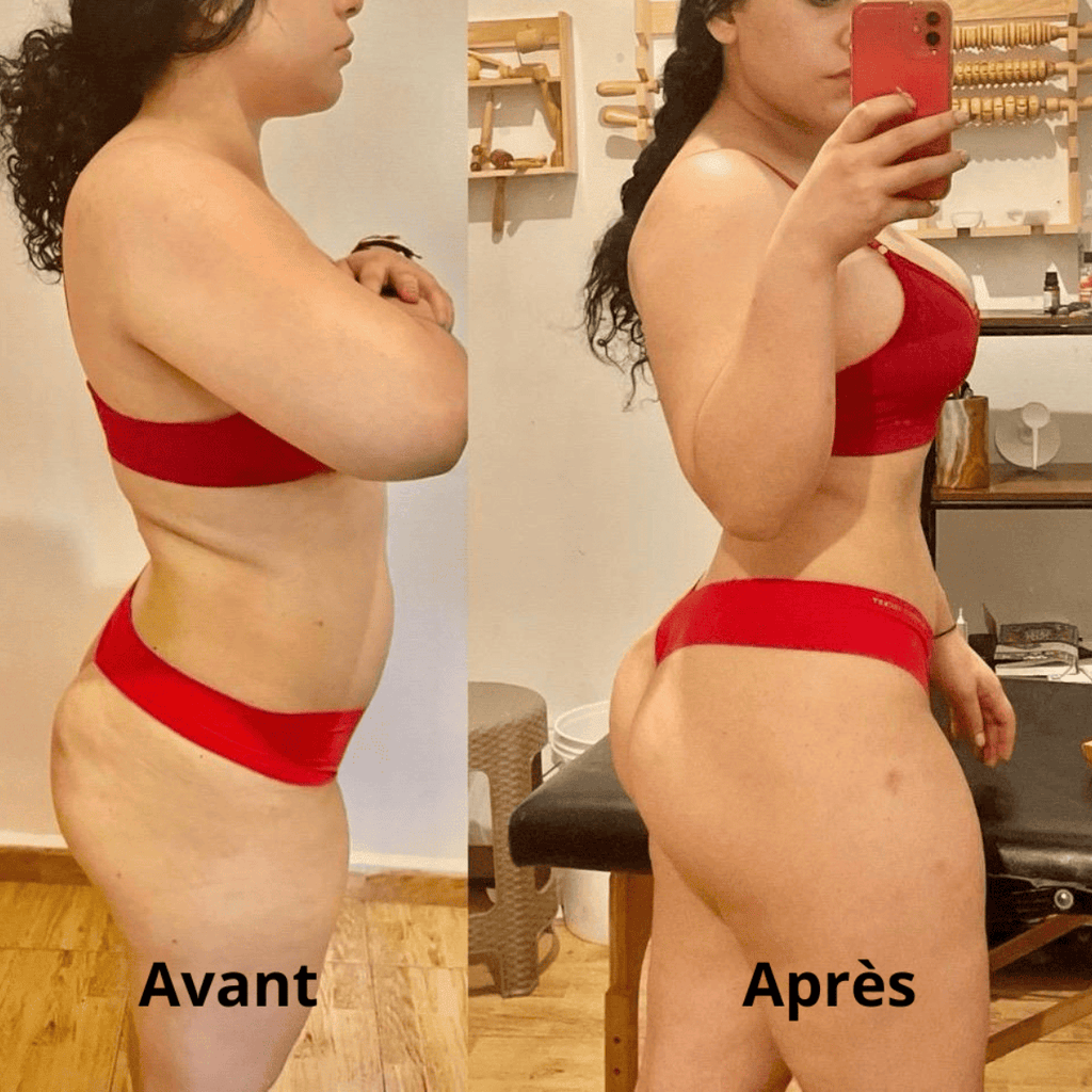 Kit madérothérapie 5 pièces